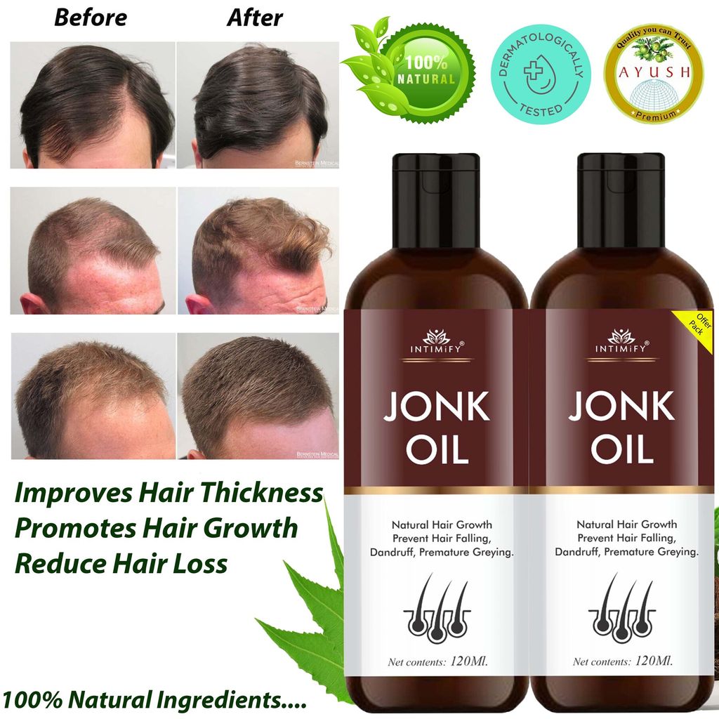 Intimify Jonk Hair Oil, hair growth oil, jonk oil, hair regrowth oil, anti haifall oil, promotes hair growth 120 ml