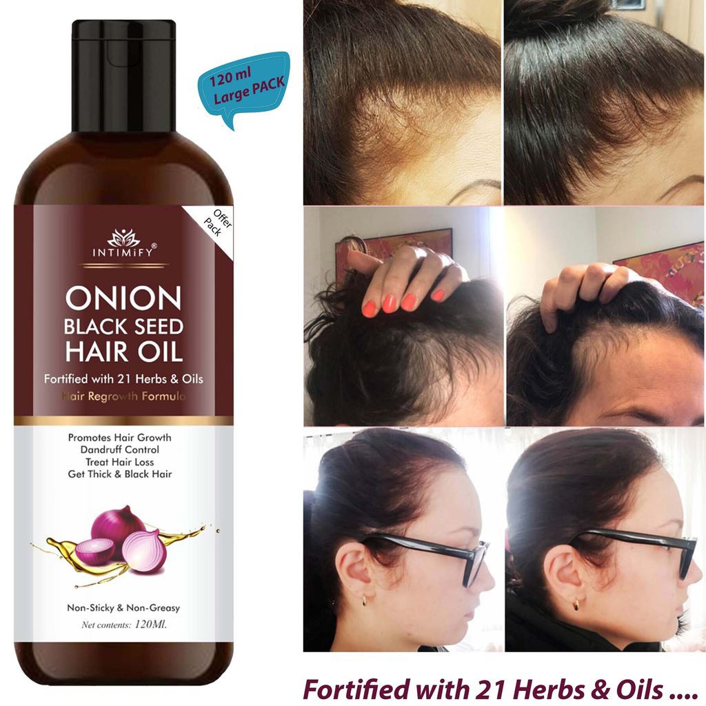 Intimify onion oil, anti dandruff oil, herbal oil, hair fall oil, red onion oil, ayurvedic oil, onion hair oil, hair growth onion oil, hair growth oil