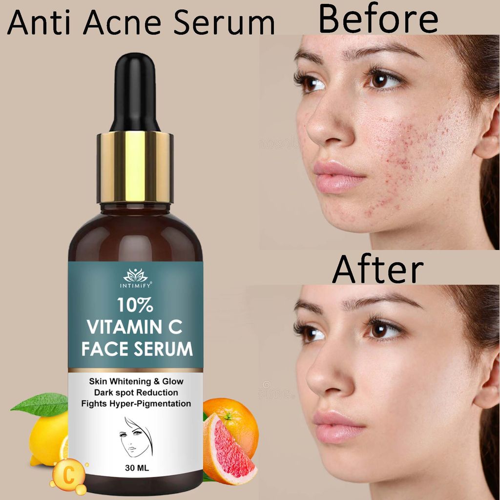 Intimify 10% Vitamin C Serum, anti acne serum, face serum, skin brightening serum, 30 ml