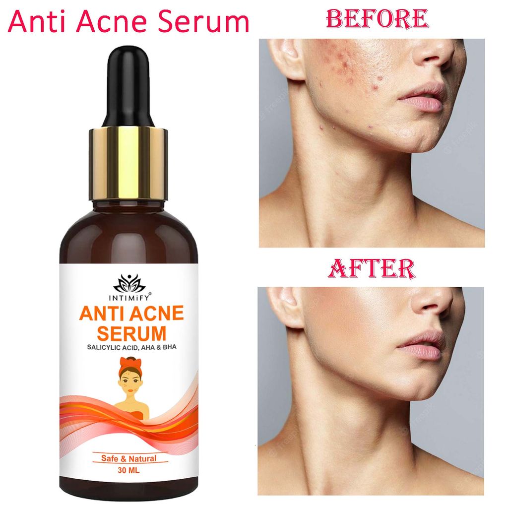 Intimify anti acne serum, anti aging wrinkles serum, face serum, skin brightening serum, anti wrinkle face serum (30 ml)