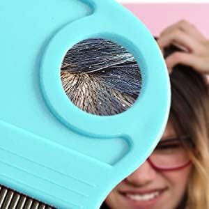 Q D Lice Nit Egg Remover Comb Removes Dendruff Dust and Louse Magnify Blue color for Men Women Kids Girl Babies and Pets
