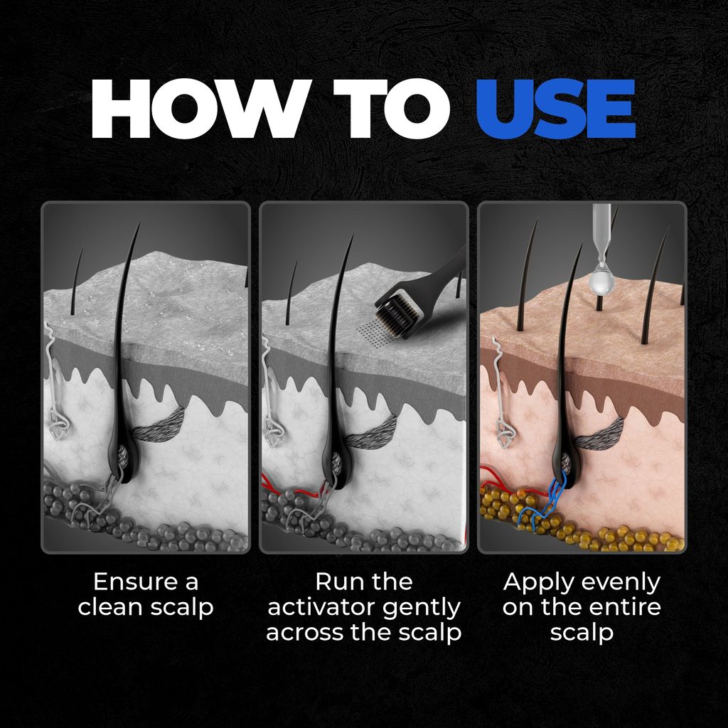 Beardo Hair Growth Pro Kit