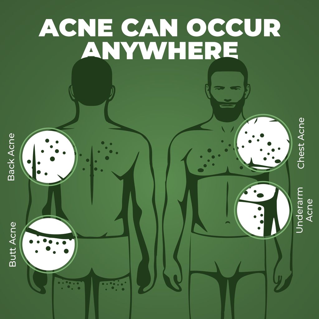 Beardo Mega Festive Combo