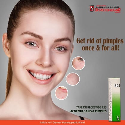 Dr. Reckeweg R53 Acne Vulgaris And Pimples Drop (PACK OF 2)