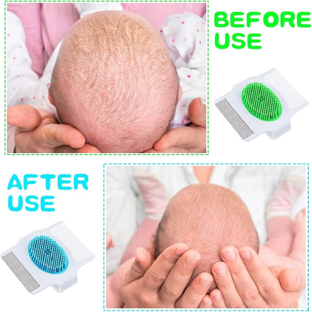 Q D Baby Scalp Shampoo Brush Hair Comb LICE NIT Silicon Scalp Massager Wet Dry Hair for Baby Girl and BOY
