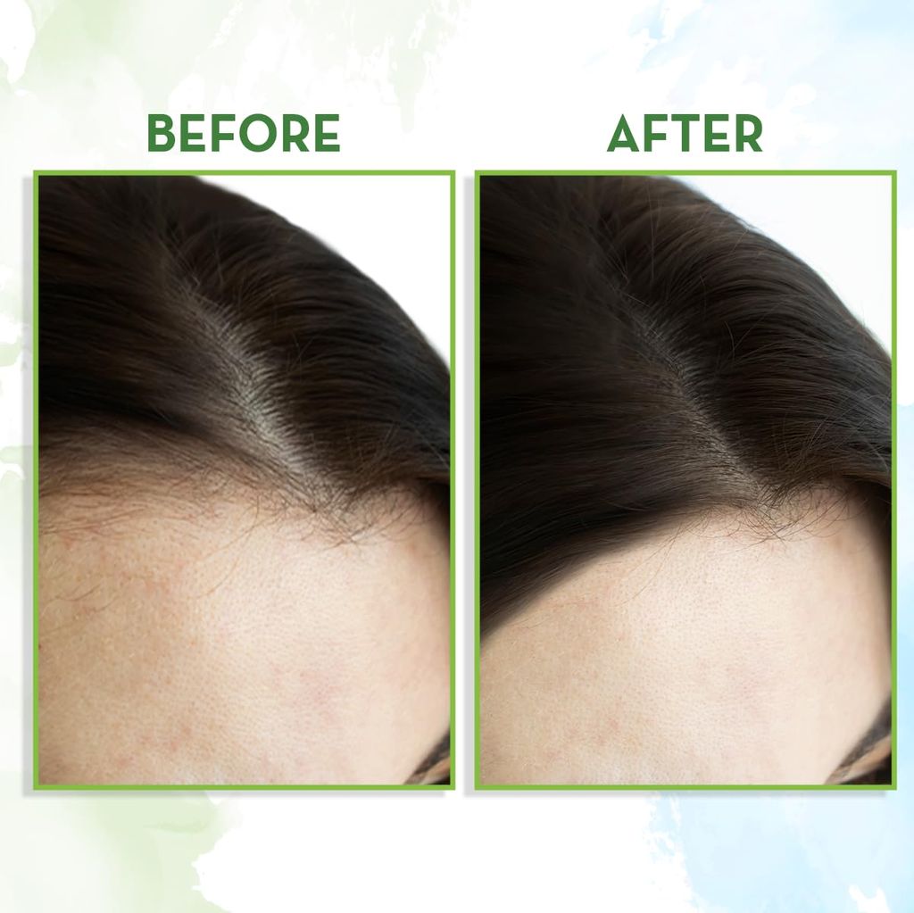 Mamaearth Rosemary Hair Growth Oil with Rosemary & Methi Dana for Promoting Hair Growth - | Controls Hair Fall | Strengthens Hair 150 ML