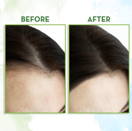 Mamaearth Rosemary Hair Growth Oil With Rosemary And Methi Dana (150ml)