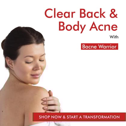 THE LOVE CO Acne Body Spray 100Ml - 02% Salicylic Acid & Niacinamide for Back, Shoulder, Chest - Fast-Acting for Severe Acne, Unclogs Pores, Soothes Redness & Irritation