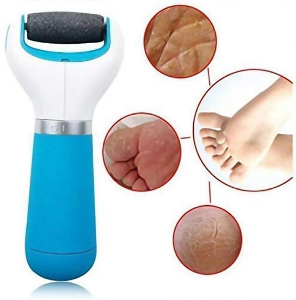 WUGO:: Foot Roller Callus Remover Hard and Dead Skin Remover Care Feet Care Callus Remover Pedicure for Hard Cracked Skin, Foot Scrubber Roller (Blue)
