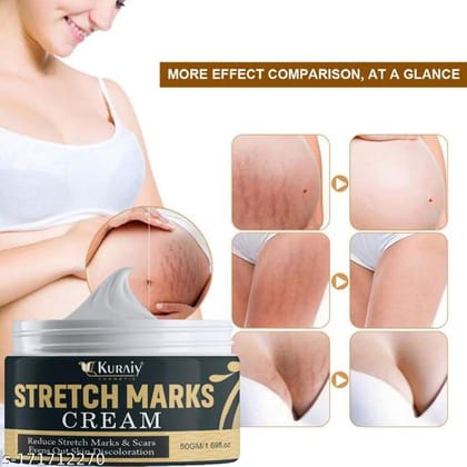 KURAIY Classy Stretch Marks And Scars Creams & Oils
