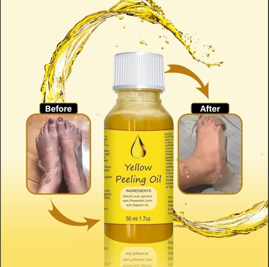 YELLOW®- PEELING OIL FOR DARK SKIN ⭐️⭐️⭐️⭐️⭐️4.8/5 (12,600+ REVIEW)