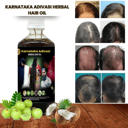Karnataka Adivasi Herbal Hair Oil-250 ML (45 Days trial package)