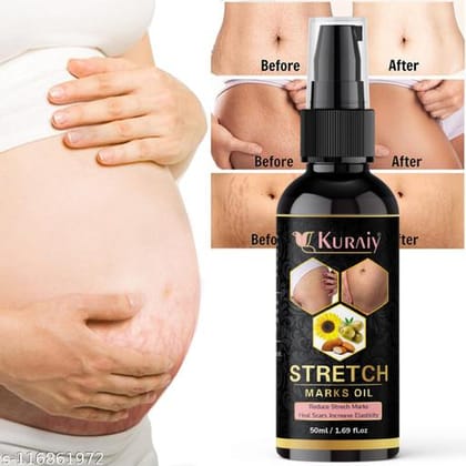 Fancy Stretch Marks And Scars Creams & Oils