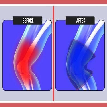 Perfect Fit Magnetic Knee Support: Unlock Pain Free Mobility