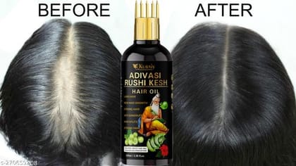 KURAIY Proffesional Proctective Herbal Oil