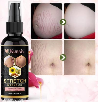 Unique Stretch Marks And Scars Creams & Oils