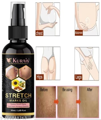 Everyday Stretch Marks And Scars Creams & Oils