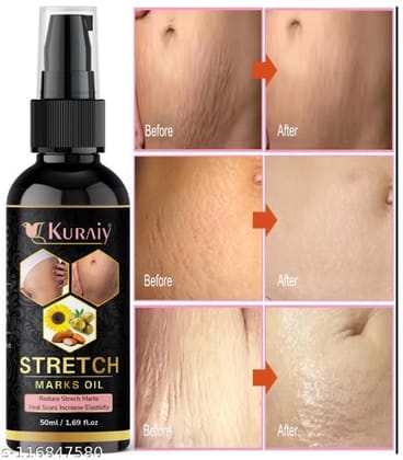 Everyday Stretch Marks And Scars Creams & Oils
