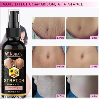 New Stretch Marks And Scars Creams & Oils