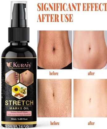 KURAIY  New Stretch Marks And Scars Creams & Oils
