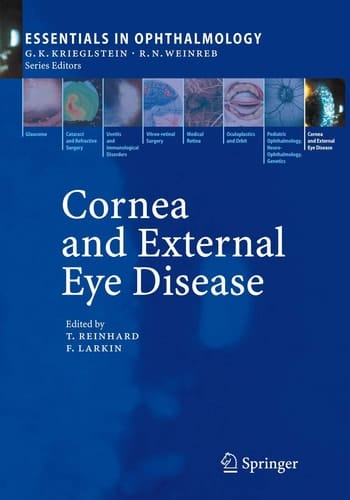 Cornea and External Eye Disease 1/ed