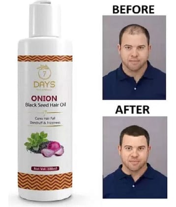 7 days - Hair Growth Onion Oil 100 ml ( Pack of 1 )