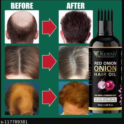 Advanced Relief Herbal Oil