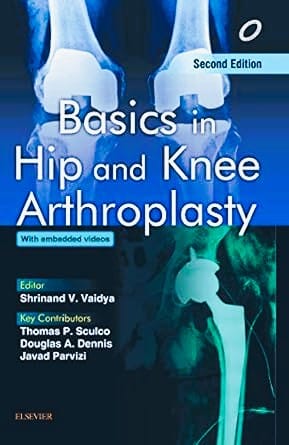 Basics in Hip and Knee Arthroplasty, 2ed