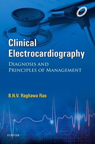 Clinical Electrocardiography: Diagnosis and Principles of Management 1st Edition 2016
