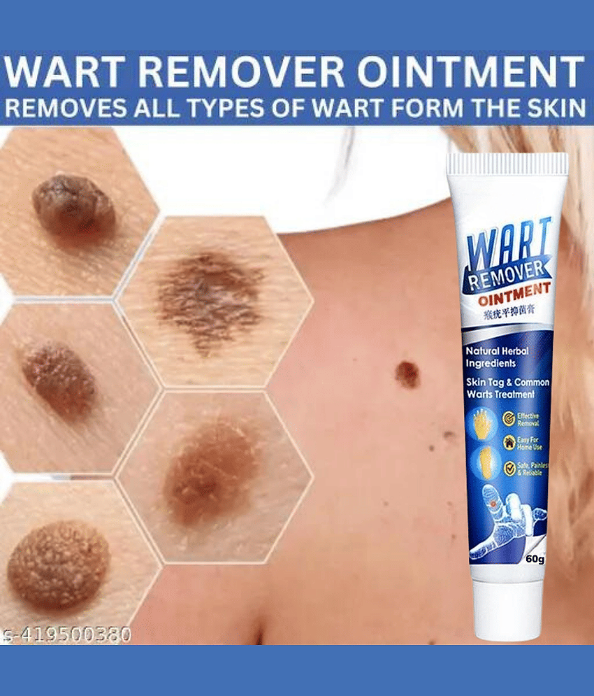 Wart Removal Ointment Skin Treatment
