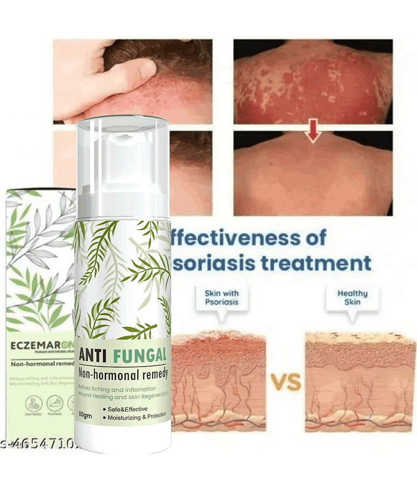 GRASHVA ORGANIC Intense Hydration Cream For Eczema Skin 50 ml ( Pack of 1 )