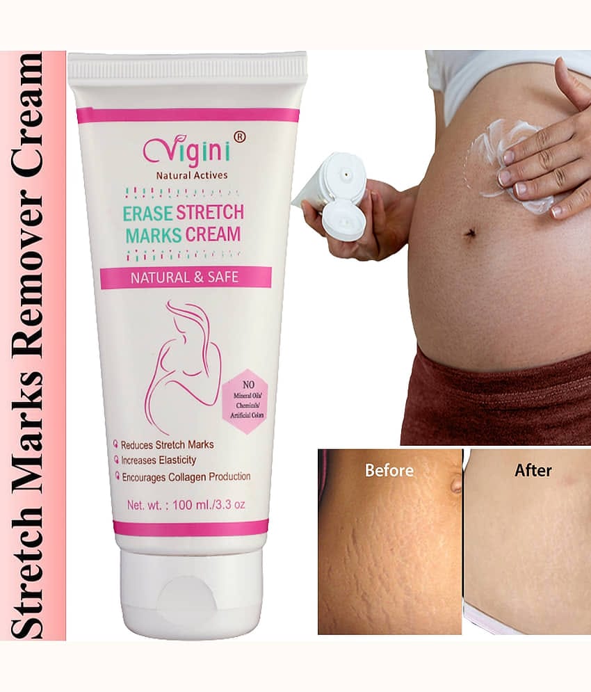 Vigini Natural Stretch Marks Removal Cream for Skin Tightening Shaping & Firming Cream 100 g