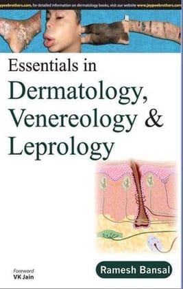 Essentials in Dermatology, Venereology & Leprology 1st Edition 2015