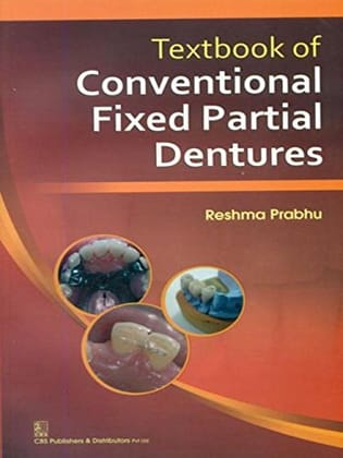 Textbook of Conventional Fixed Partial Dentures 1/ed ( 2014 )