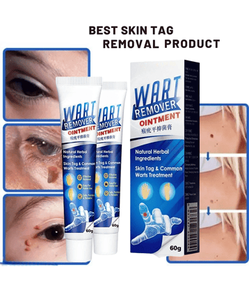 Massa Cream for Remove Warts&nbsp;Blackhead Remover