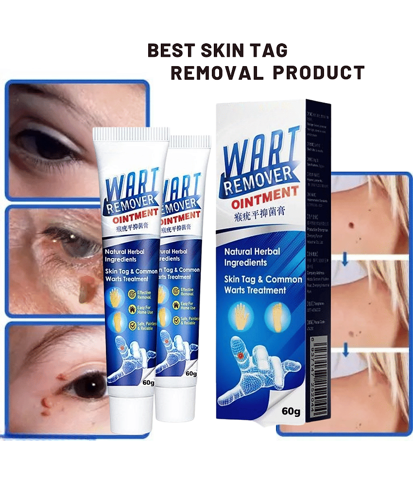 Massa Cream for Remove Warts&nbsp;Blackhead Remover
