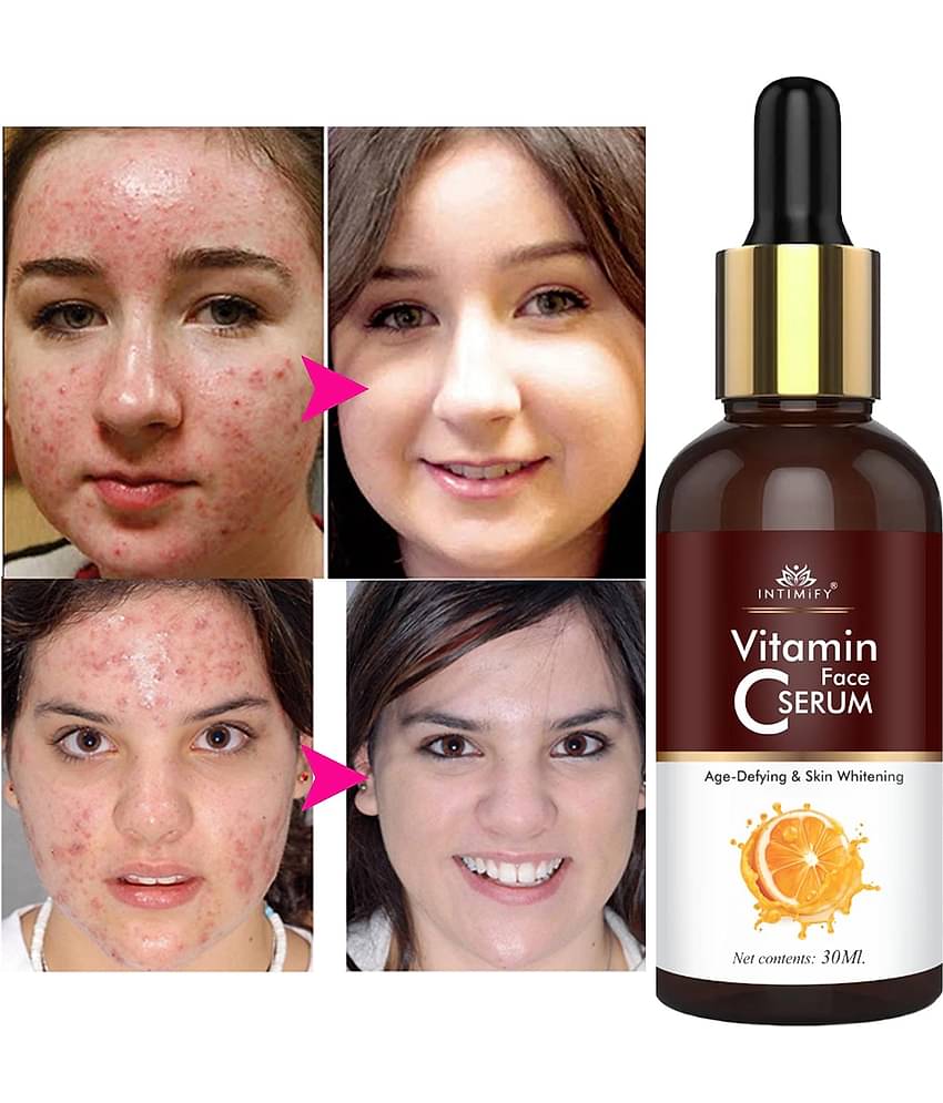 Intimify Acne Removal Face Serum, Vitamin C Serum, Anti Acne Serum, 30 Ml