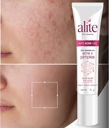 Alite Night Cream All Skin Type Tea Tree ( 15 gm )