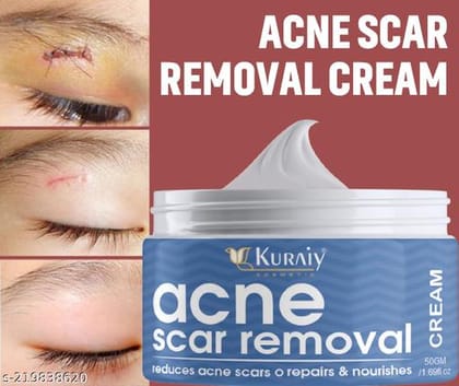 KURAIY Classy Stretch Marks And Scars Creams & Oils