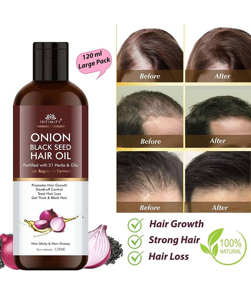 Intimify Onion Black Seed Hair Oil, onion oil, hair onion oil, herbal onion oil, hair growth oil, anti hairfall oil, 120 ml