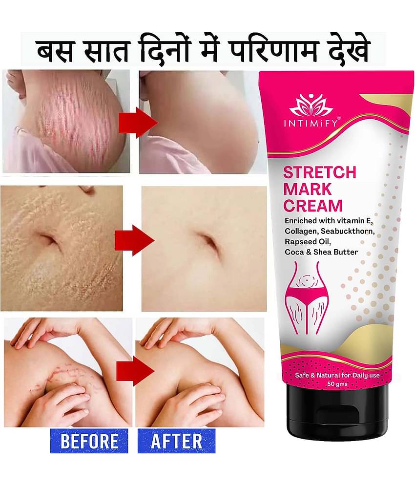 Intimify Stretch Mark Cream, Stretch Mark Remover Cream, Shaping & Firming Cream 50 gms