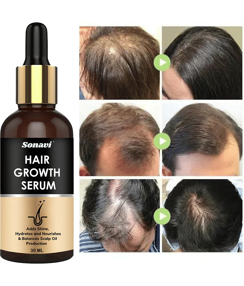 Sonavi Hair Serum 30 mL