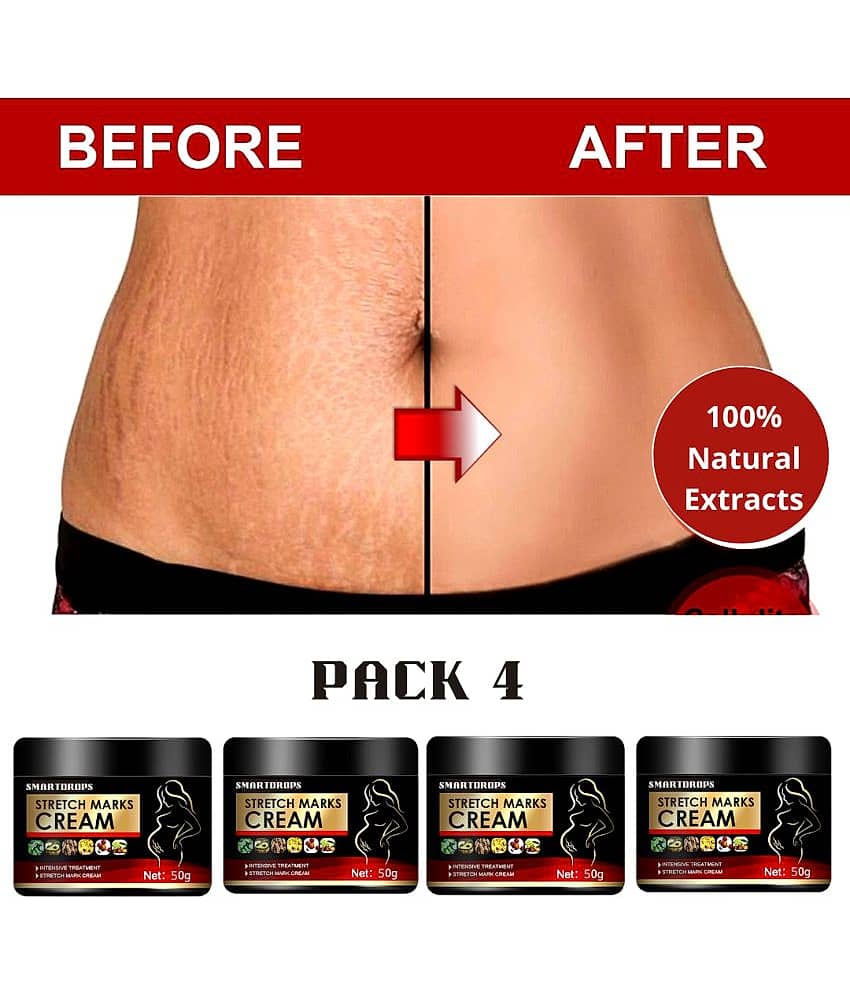 Smartdrops Pragnancy Stretch Mark Remove Cream Shaping & Firming Cream 50 g - Pack of 4