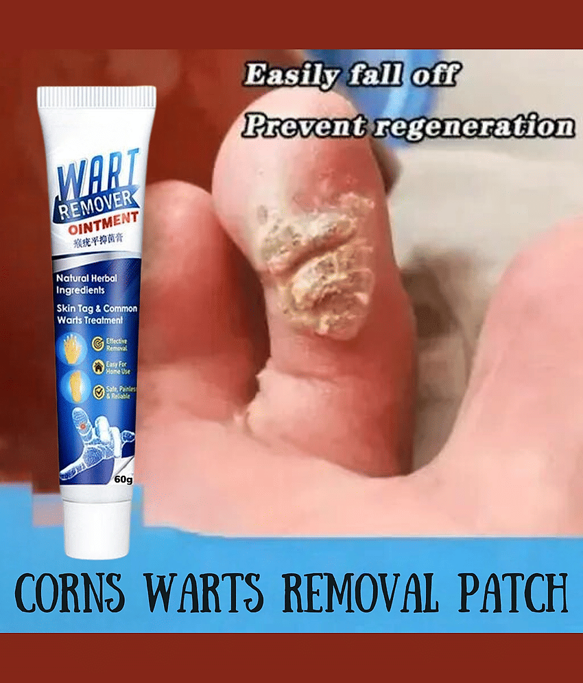 Remover Wart Without Leaving scars and refuse to repeat Herbal Ingrediants All Skin Type Use For Men And Women