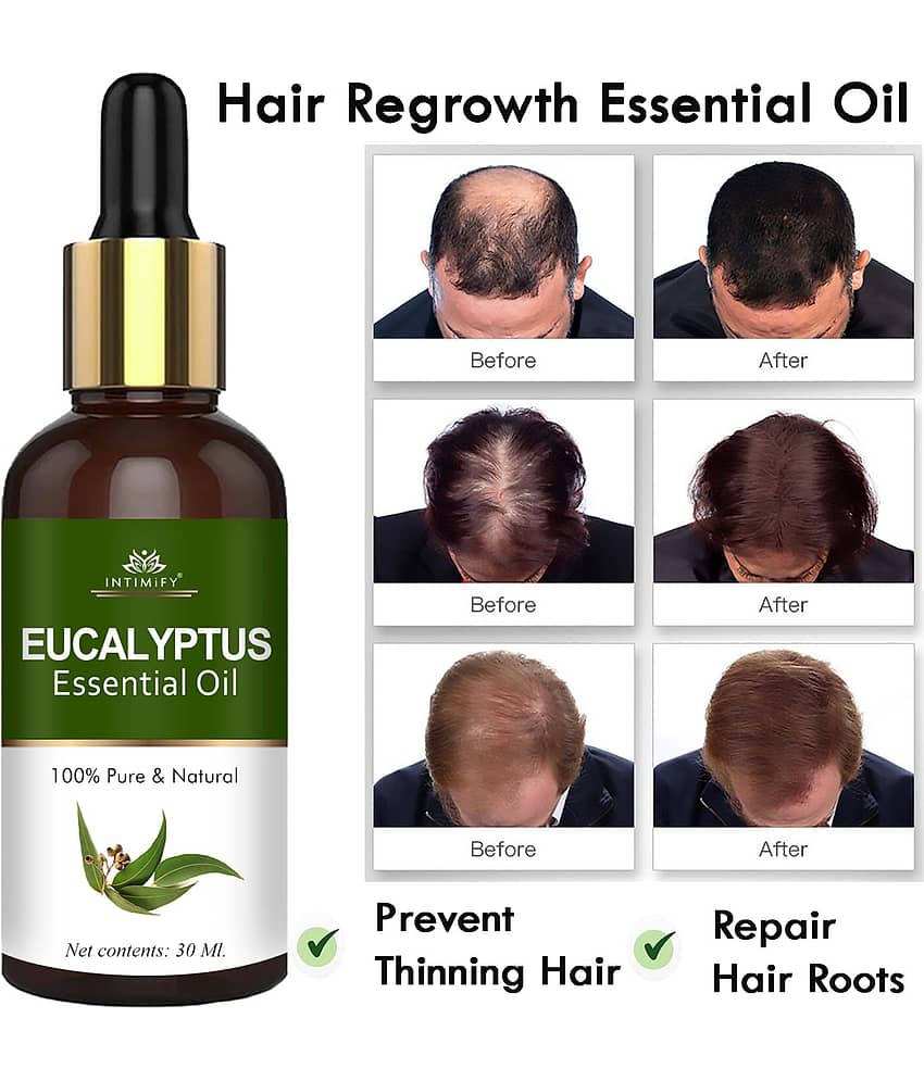 Intimify Eucalyptus Essential Oil, Hair Growth Oil, Hair Inhabiter Oil, Hair Loss Oil, 30 Ml