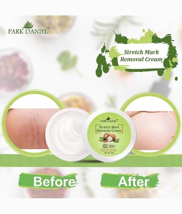 Park Daniel Strecth Marks Removal Cream After Weight Loss and Pregnancy Pack of 1 of 100 Grams