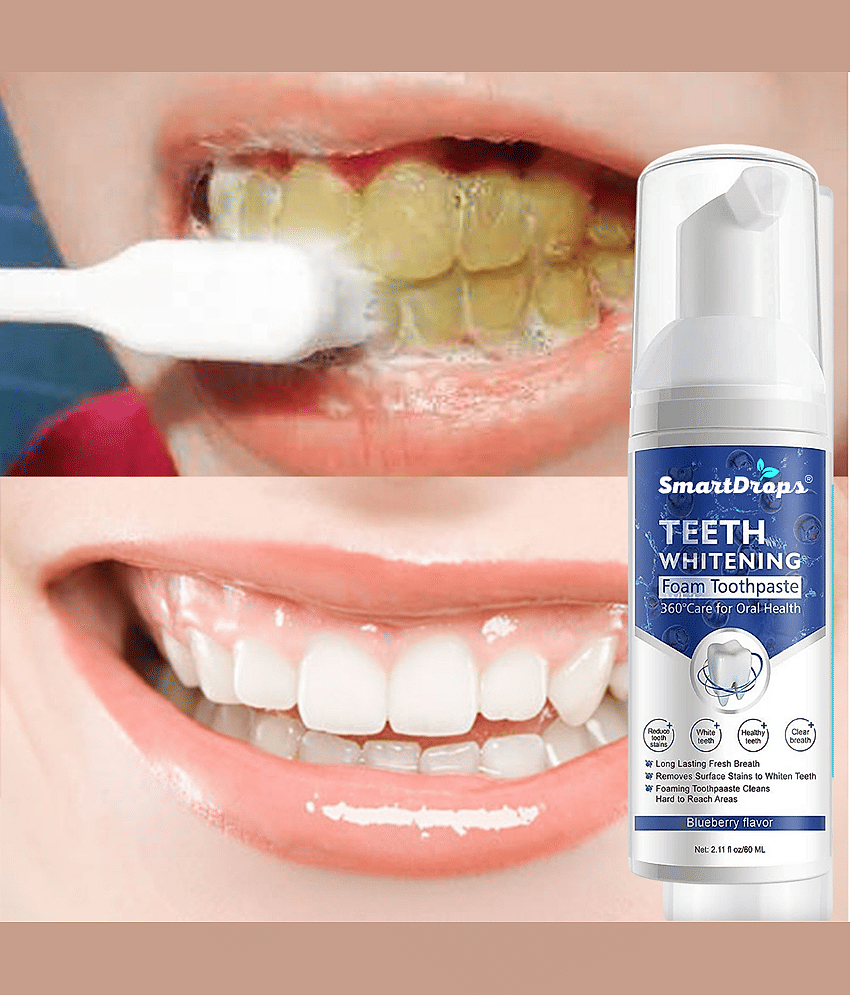 Smartdrops Teeth Whitening Denture Oral Kit