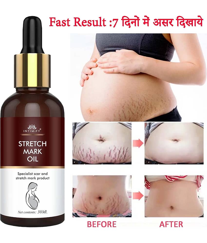 Intimify stretch mark massage oil, stretch mark remover, Shaping & Firming Oil 30 mL
