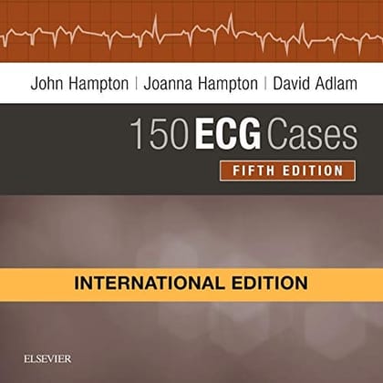 150 ECG Cases IE 5th Edition 2019