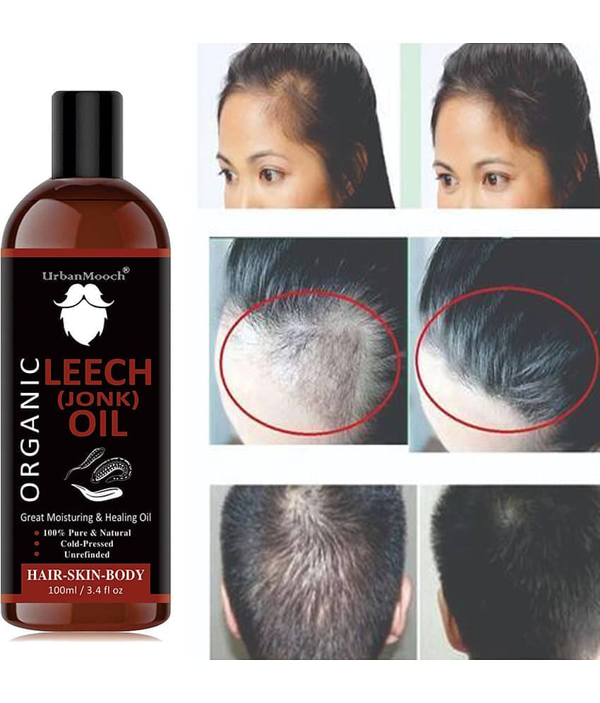 UrbanMooch Natural Jonk Leech Oil For Hair Growth & Dandruff Oil- 100 mL